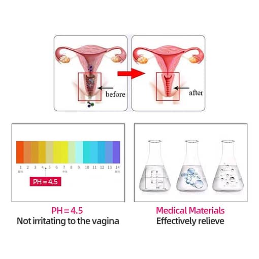 Herbal Vaginal Tightening Supository Melts Ovule Womb Vaginale Detox Gynaecology Vagina Tighten Medical Vaginitis Treatment 4