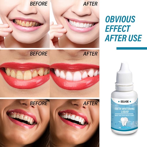 Teeth Whitening Essence Liqud Oral Hygiene Cleaning Whiten Tooth Serum Remove Oral Odor Plaque Stains Dental 1
