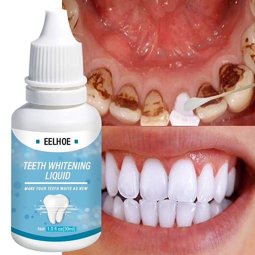 Teeth Whitening Remove Odor Plaque Stains